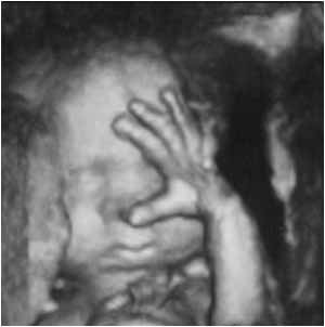 Baby Ireland Tonner Meade